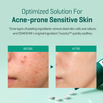 Some By Mi – AHA BHA PHA Miracle Toner (14 Days Edition)