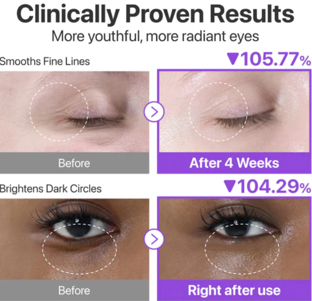 Numbuzin No.9 – Crème Contour des Yeux Volumetox