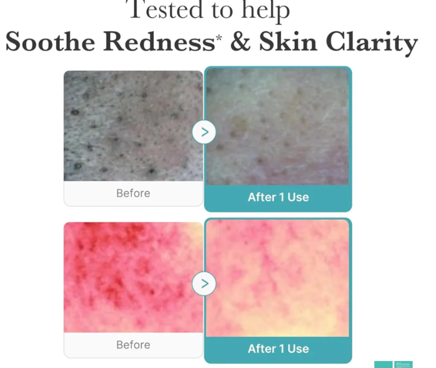 Medicube Azelaic Acid Niacinamide Deep Clean Foam Cleanser