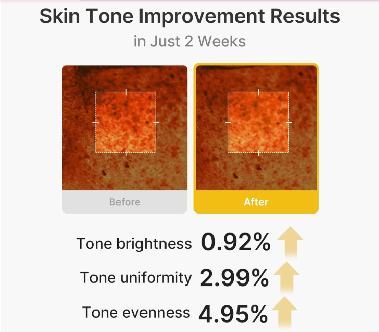 Crème Capsule Kojic Acid & Curcuma – Éclat Anti-Taches Vita C Medicube
